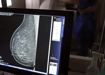 Outubro Rosa: Iaspi isenta pagamento de coparticipação do exame de mamografia durante todo este mês