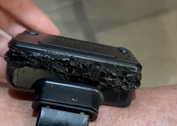 Bolsonaro mostra tornozeleira queimada e admite uso de ferro de solda