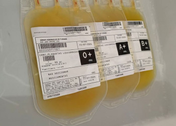 Hemopi inicia produção e distribuição de plaquetas em Floriano e descentraliza serviço