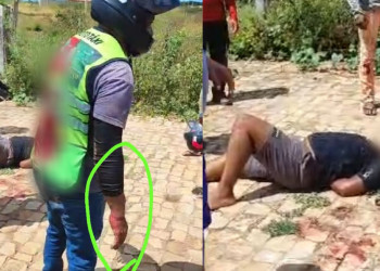 Mototaxista é esfaqueado e tem braço quebrado durante tentativa de assalto no Piauí