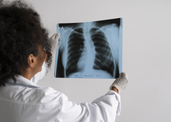 Pesquisa analisa custos do tratamento da tuberculose durante semana de prevenção no estado