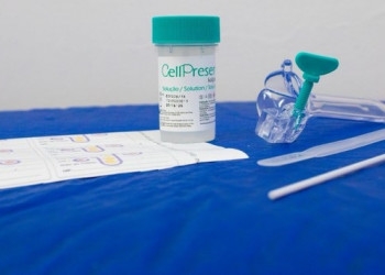 Sesapi distribui testes DNA-HPV a municípios do projeto piloto de prevenção ao câncer do colo do útero