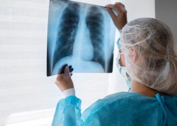 Pesquisa avalia impacto financeiro da tuberculose em famílias piauienses