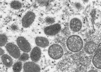 Brasil investiga caso suspeito da varíola do macaco no Ceará