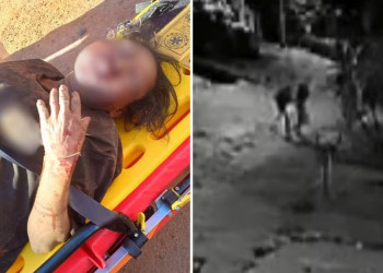 Mulher é estuprada e tem rosto desfigurado após ser arrastada por homem para terreno baldio