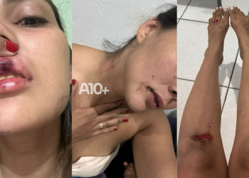 Ex-namorado suspeito de agredir engenheira em via pública no Piauí tem prisão preventiva decretada