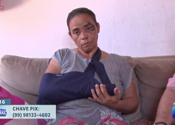 Faxineira atropelada em Timon, no Maranhão, pede ajuda após ficar impossibilitada de trabalhar