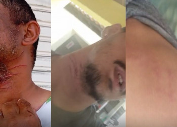 Vendedores ficam feridos após serem atingidos por arame farpado que teria sido colocado na estrada para realizar assaltos no Piauí