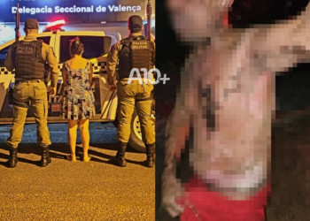 Mulher é presa após atear fogo em companheiro no Piauí; vítima ficou com graves queimaduras