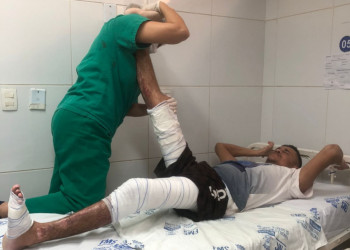 Paciente que teve 40% do corpo queimado após cair em forno de cerâmica no Piauí se recupera