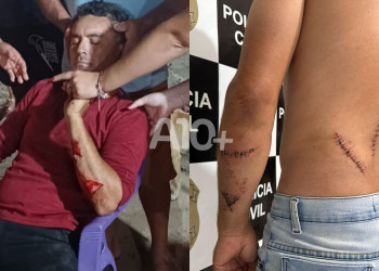 Lavrador é esfaqueado em bar durante briga motivada por dívida de cavalo no Piauí