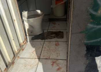 Adolescente é baleado ao tentar furtar cordão de policial na zona Sul de Teresina; comparsa fugiu