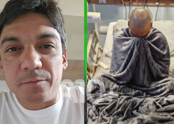 Bruno Neto, prefeito de Angical, comemora sucesso do transplante de medula óssea