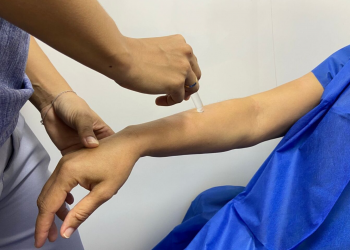 Carreta da Hanseníase confirma dois casos da doença em manhã de atendimento em Teresina