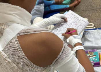Em Teresina, atividades lúdicas mudam rotina de crianças do setor de queimados no HUT