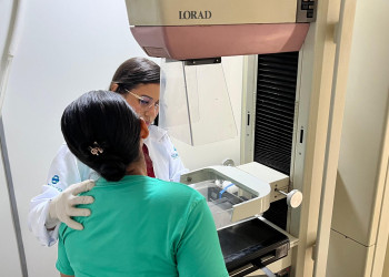 Outubro Rosa: Piauí já realizou mais de 57 mil mamografias em 2025