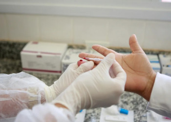 Ministério da Saúde realiza oficina sobre eliminação da Aids e do HIV no Piauí