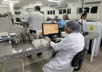 FMS passa a ofertar os exames HTLV e vitamina D em Teresina