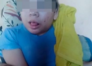 Mãe denuncia descaso da Prefeitura de Bom Princípio e assistência social por abandono de filha cadeirante: “Minha filha fica sempre pra trás”