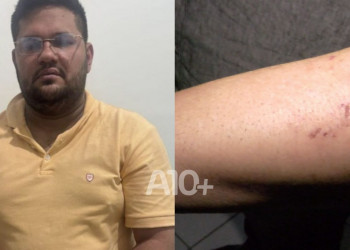 “Drácula”, membro do PCC, é preso após perseguição na zona Sul de Teresina; criminoso ainda mordeu policial