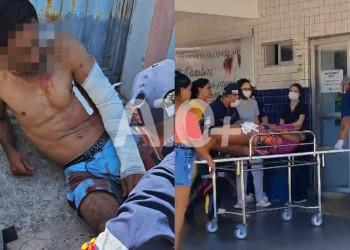 Homem e mulher sofrem tentativa de homicídio ao serem baleados no litoral do Piauí