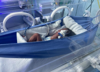 Nova Maternidade usa redinhas para promover conforto e desenvolvimento de bebês prematuros em Teresina