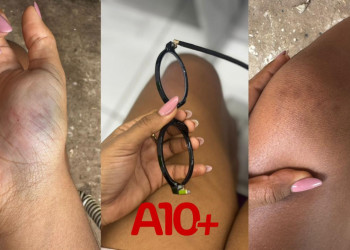 Influencer denuncia ex-companheiro por agressão em Teresina: “tentou passar com o carro por cima de mim”