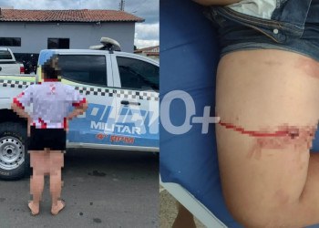 Mulher é presa após esfaquear o companheiro no interior Piauí; alegou que era agredida por ele