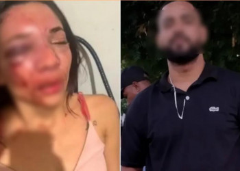 Mulher fica com rosto desfigurado após ser agredida por companheiro no interior do Piauí