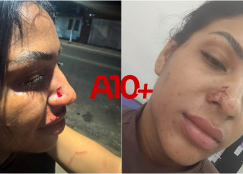 Após expor o ex-companheiro em rede social, influencer denuncia agressões em Teresina: “armou pra mim”