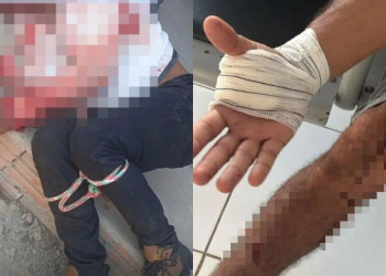 Irmãos reagem a assalto, são baleados e imobilizam criminoso no Piauí; lista com nomes de estabelecimentos é apreendida