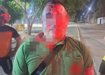 ​Vigilante é agredido por bandido na zona Norte de Teresina; criminoso ia atirar contra vítima, mas arma falhou