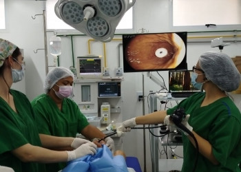 Hospital Alberto Neto, em Teresina, passa a realizar gastrostomia endoscópica pelo SUS