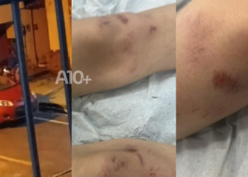 Adolescente é espancado por dois homens e fica internado em hospital no Piauí