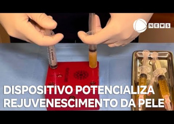 Novo dispositivo potencializa rejuvenescimento da pele