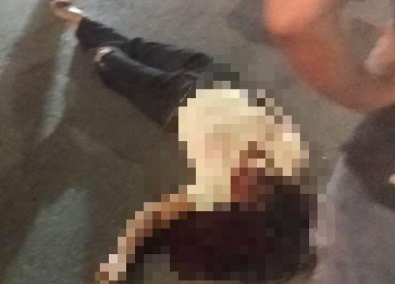 Mulher fica gravemente ferida após bater motocicleta contra proteção de concreto e poste na BR-316, em Teresina