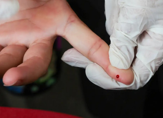 Fundação Municipal de Saúde disponibiliza testes rápidos da dengue em 3 UPAs e 2 hospitais de Teresina