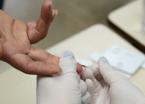 MPF abre procedimento para acompanhar aumento de casos de HIV no Brasil