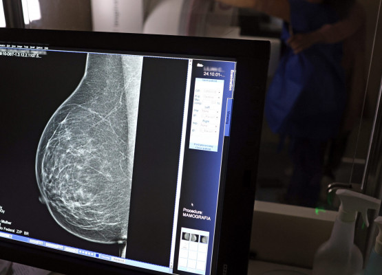 Prevenção do câncer de mama: confira o passo a passo para fazer mamografia gratuita pelo SUS no Piauí