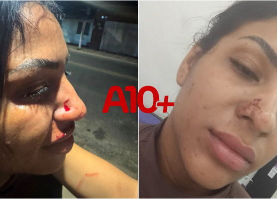 Após expor o ex-companheiro em rede social, influencer denuncia agressões em Teresina: “armou pra mim”