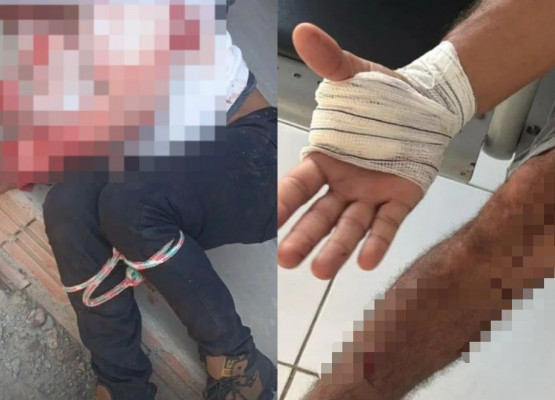Irmãos reagem a assalto, são baleados e imobilizam criminoso no Piauí; lista com nomes de estabelecimentos é apreendida