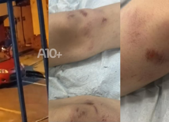 Adolescente é espancado por dois homens e fica internado em hospital no Piauí