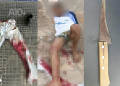 Suspeito de tentar estuprar adolescente é baleado por policial após fuga no Piauí; teria invadido casa e colocado faca na barriga da vítima