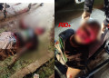 Homem sofre tentativa de homicídio e fica com rosto desfigurado no Piauí; já tinha registrado BO sobre ameaças