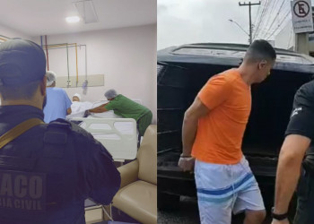 Suspeito de assaltar bancos é preso pela polícia após procedimento estético em hospital de Teresina