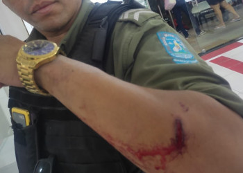 Sargento da PM é baleado no braço por criminoso em abordagem na zona Leste de Teresina