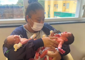 Após ser mãe de gêmeos há 10 meses, mulher dá à luz a trigêmeos em Santa Catarina