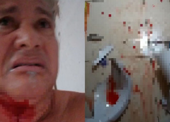Jornalista Walcy Vieira fica ferido após cair em banheiro e bater cabeça em vaso sanitário
