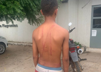 Adolescente de 13 anos é chicoteado por suspeita de furtar esporas no Piauí