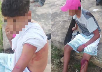 Adolescente é esfaqueado no Piauí; suspeito alega que teve vídeo íntimo vazado pela vítima